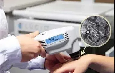 成都治白癜风哪家医院最好