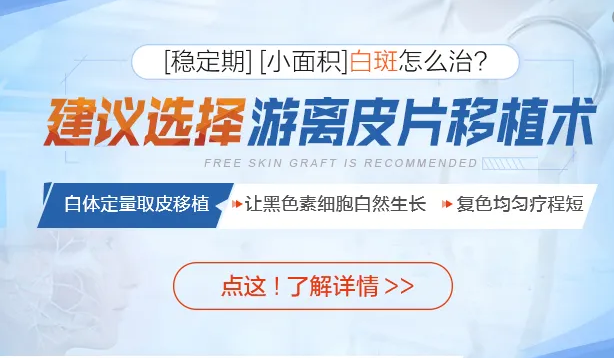 成都比较好的白癜风医院