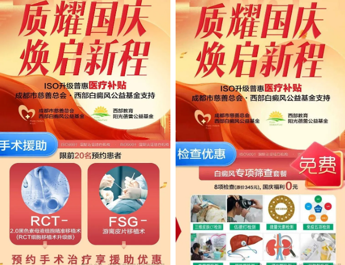 成都治白癜风哪家医院最好